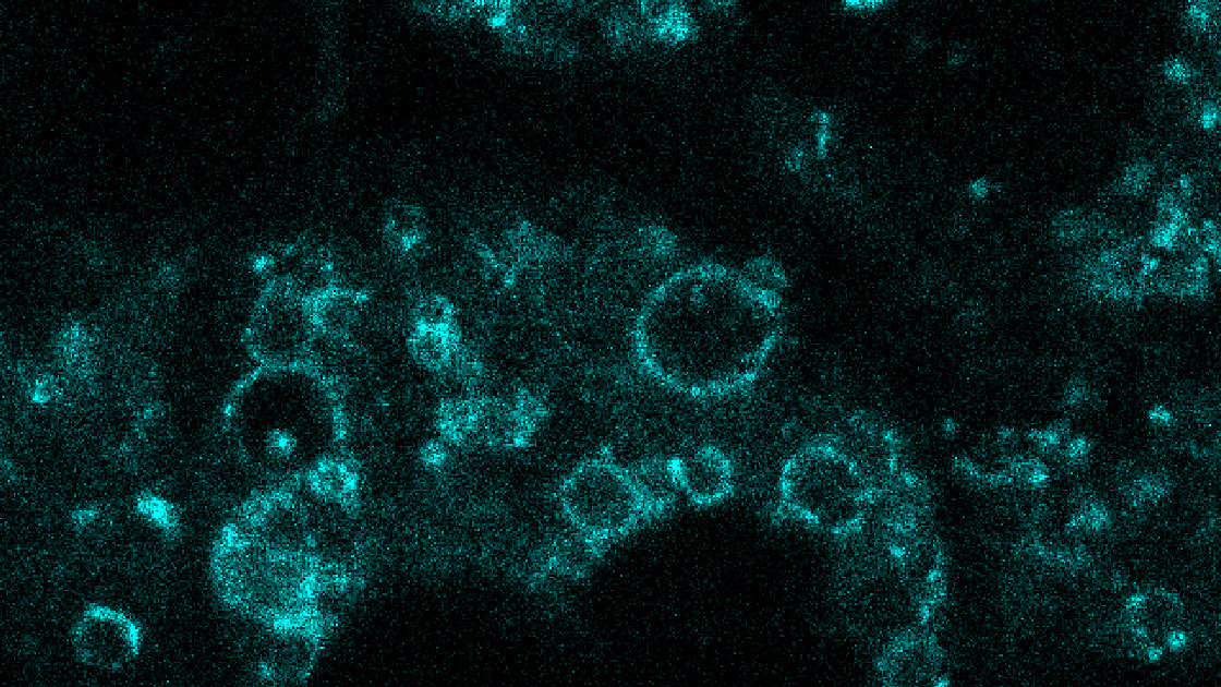 Segmentation quality for GFP-Rab7a: Raw GFP-Rab7a