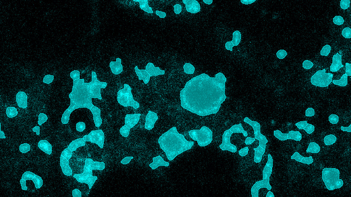 Segmentation quality for GFP-Rab7a: Rab7a segmentation