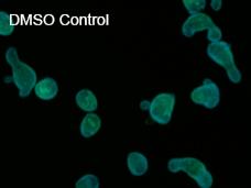 Figure 2D: Overview images of organoids that were treated with and without Wnt inhibitor. The images show that Wnt inhibition changes the morphology of the organoids, including size and shape. Control-treated organoids are larger and have an irregular shape.