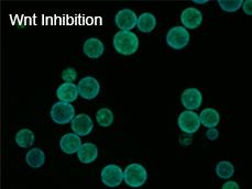 Figure 2D: Overview images of organoids that were treated with and without Wnt inhibitor. The images show that Wnt inhibition changes the morphology of the organoids, including size and shape. Control-treated organoids are larger and have an irregular shape.