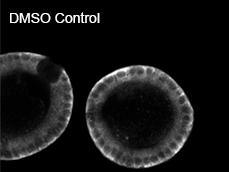 Figure 2E: Control-treated organoids are larger and have an irregular shape. Figure 2E shows how Wnt inhibition presumably reduces the expression of Aldolase B.