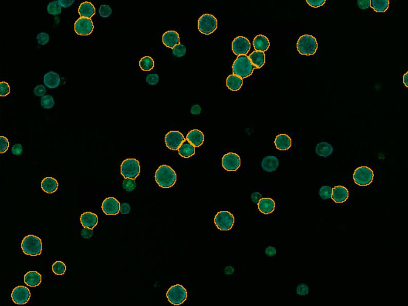 Figure 2B: Identification of areas of interest.