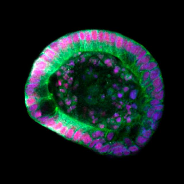 Detailed confocal scan using Airyscan detector.