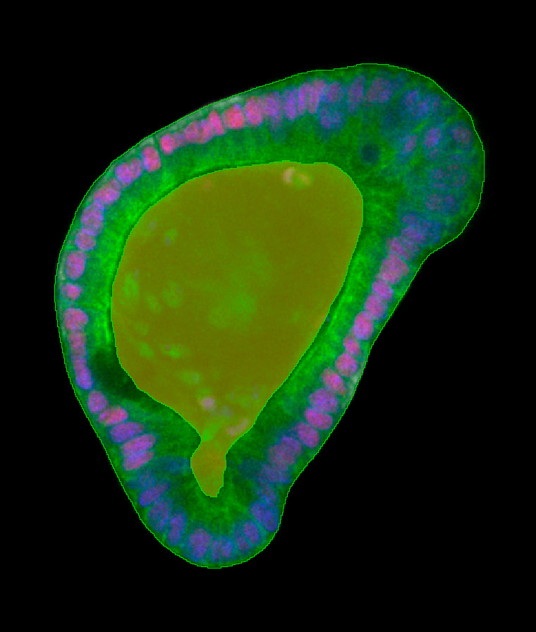 Figure 3A: Organoid cell layer and lumen segmentation