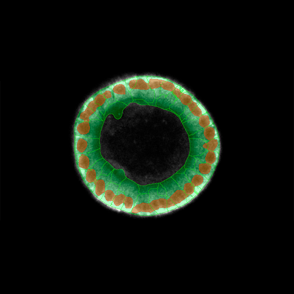 Figure 6A: Localization of Aldolase B expression in the organoids