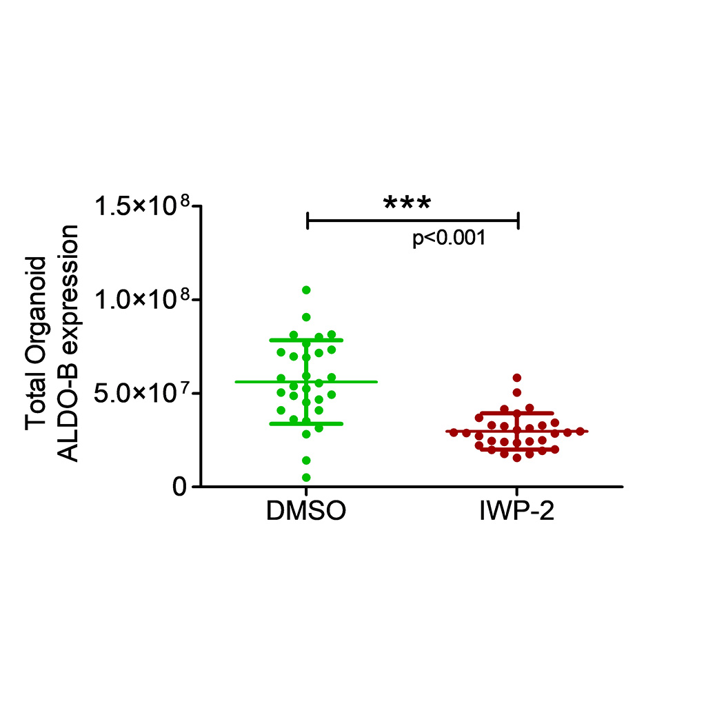 Figure 6B: Total organoid Aldolase B expression