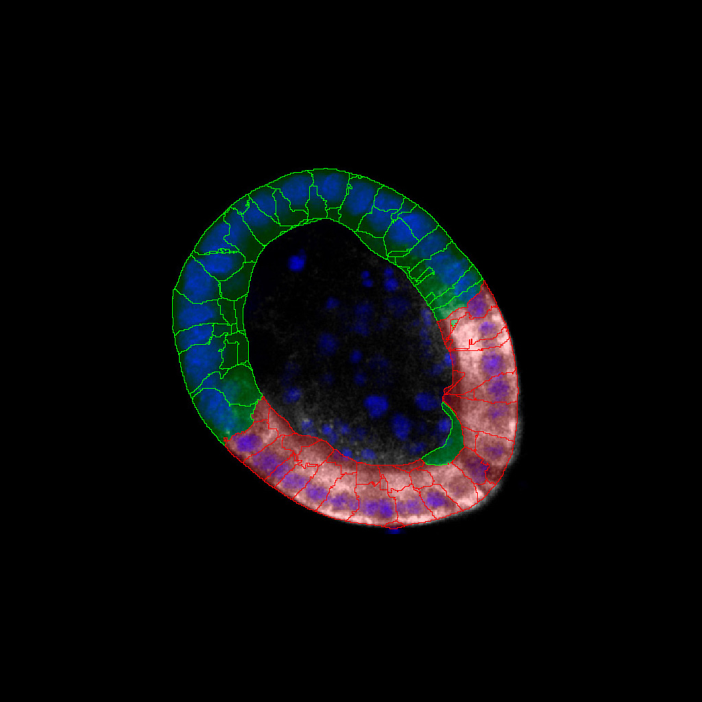 Figure 7A: Localization of Aldolase B expression in the organoids