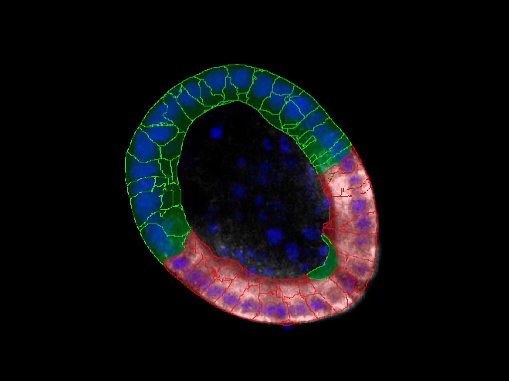 Figure 7A: Localization of Aldolase B expression in the organoids