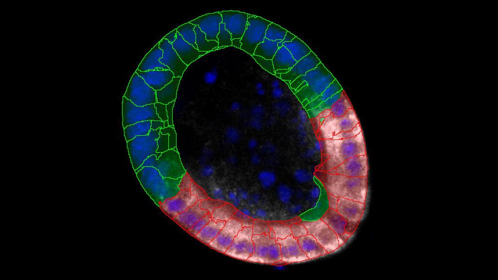 Analyze the Volume of Organoids and Their Lumen to Quantify Growth and Differentiation