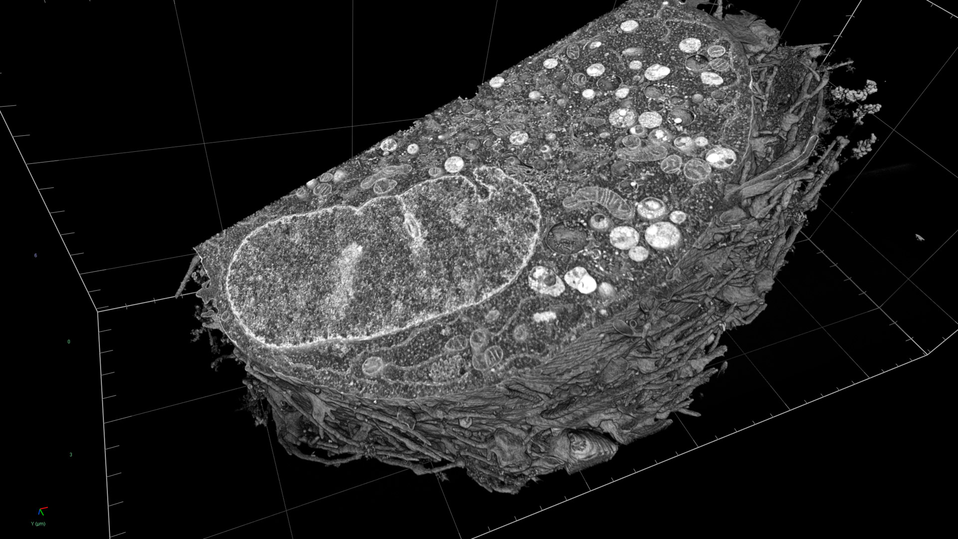 HeLa cell image set with a cropped cross section to visualize organelles, including the nucleus and mitochondria