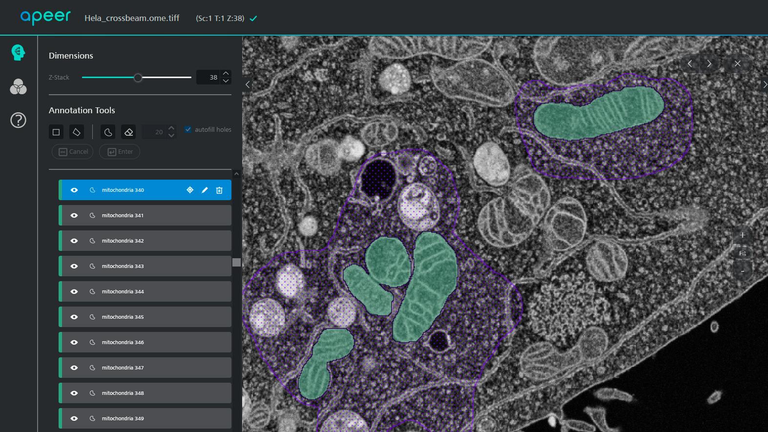 Drawing objects on mitochondria