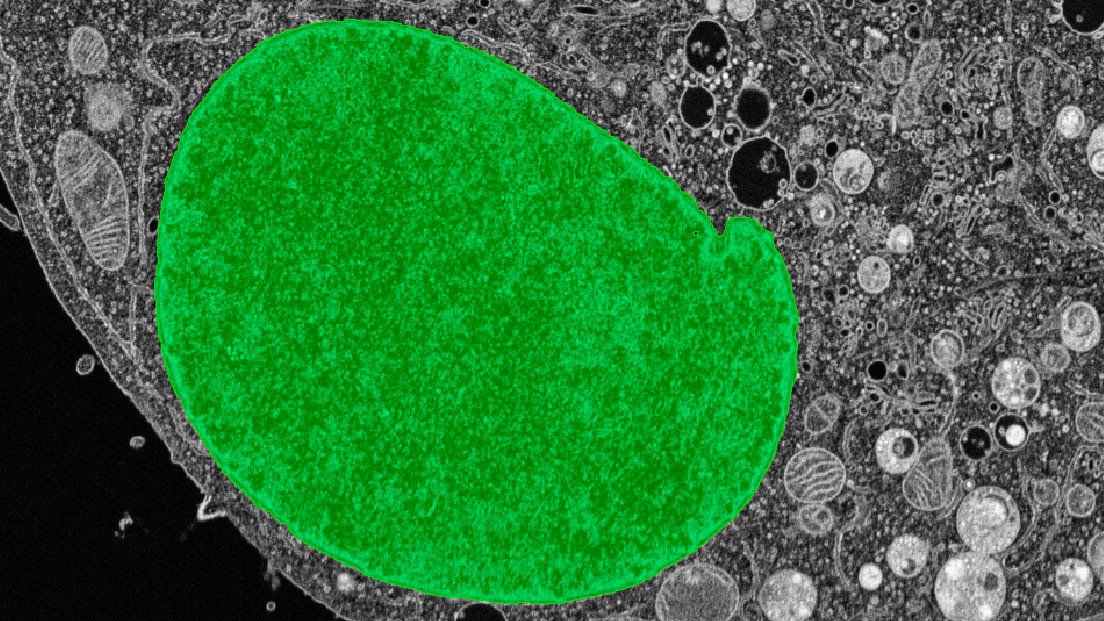 Identification of pocket objects under the nuclear membrane