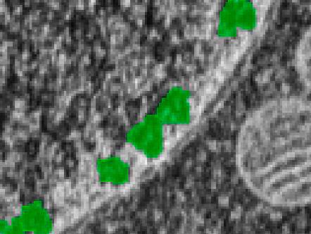 Pockets under nuclear pores can be used to identify and visualized nuclear pore complexes