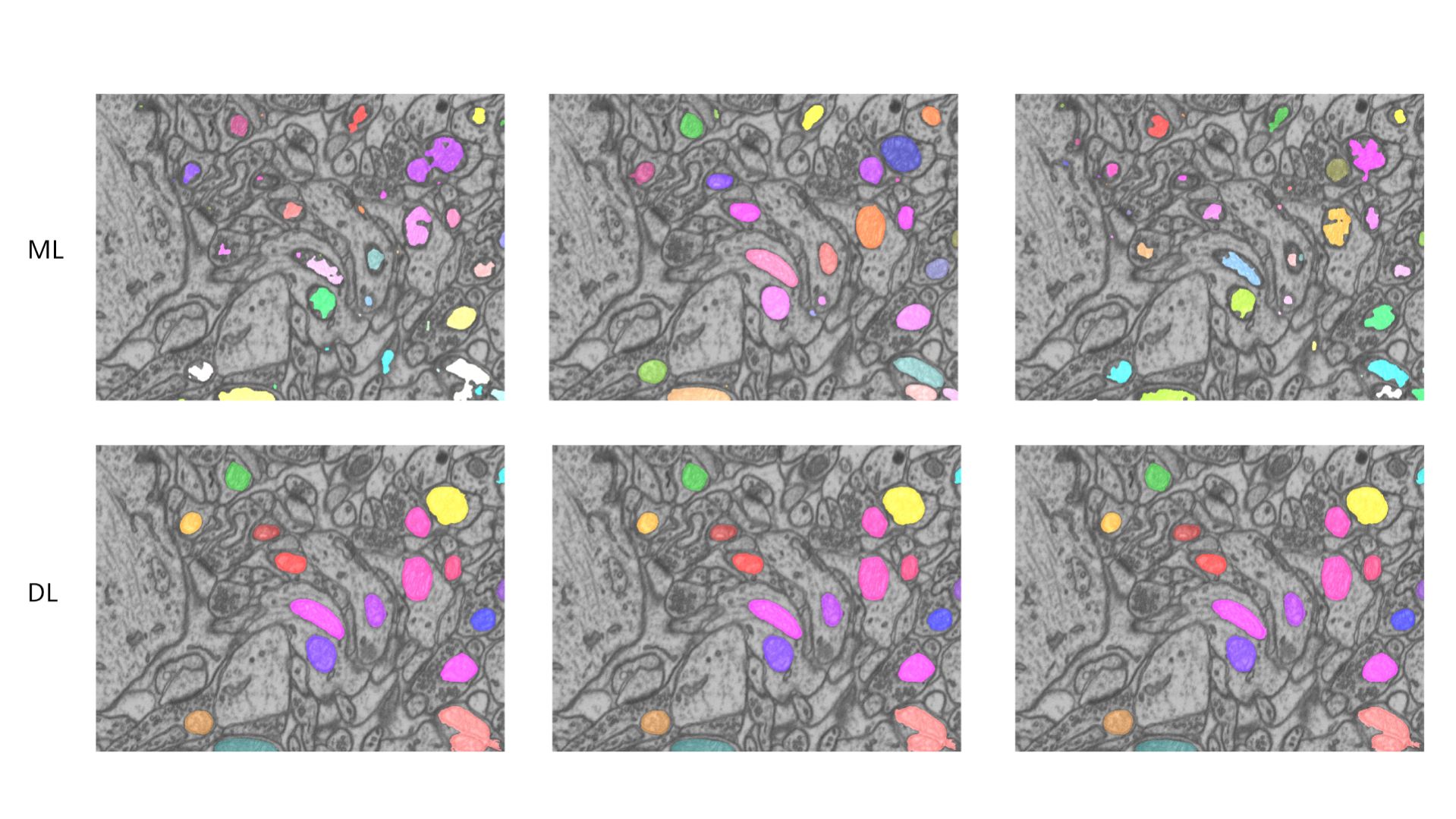 Two rows of mitochondria images showing various segmented colored regions. The top row is labeled "ML" which stands for machine learning. The bottom row is labeled "DL” which stands for deep learning. The images segmented with deep learning have more and larger colored regions which corresponds to a more detailed segmentation.