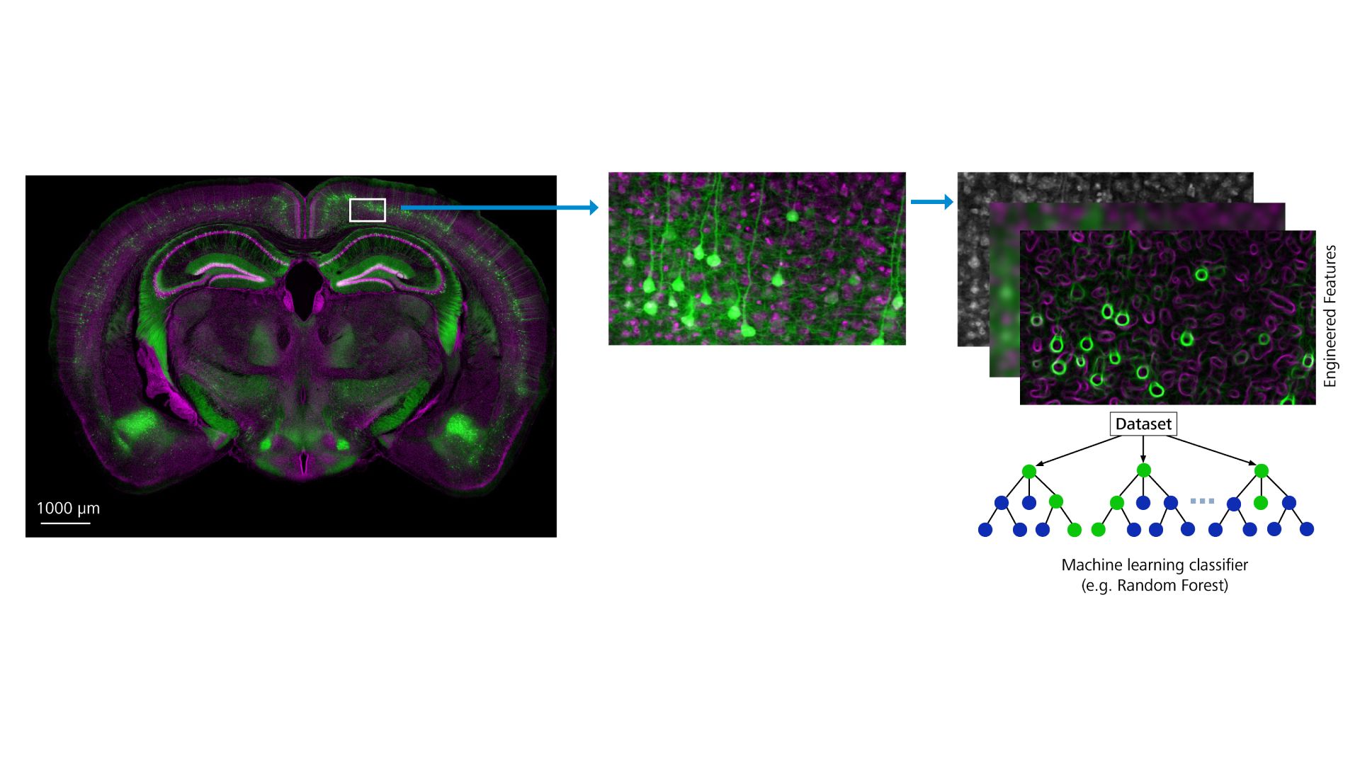A fluorescent microscopic image of a brain section on the left leads to a detailed view on the right, which is analyzed using a machine learning classifier, shown as a decision tree diagram.