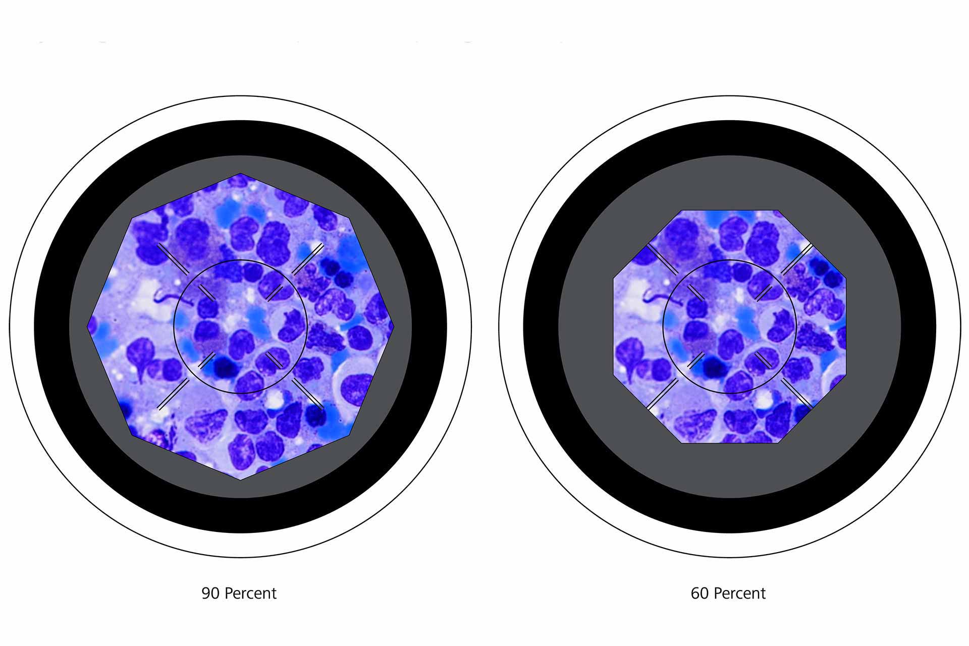 Adjusting the Condenser Aperture Diaphragm for Optimum Contrast