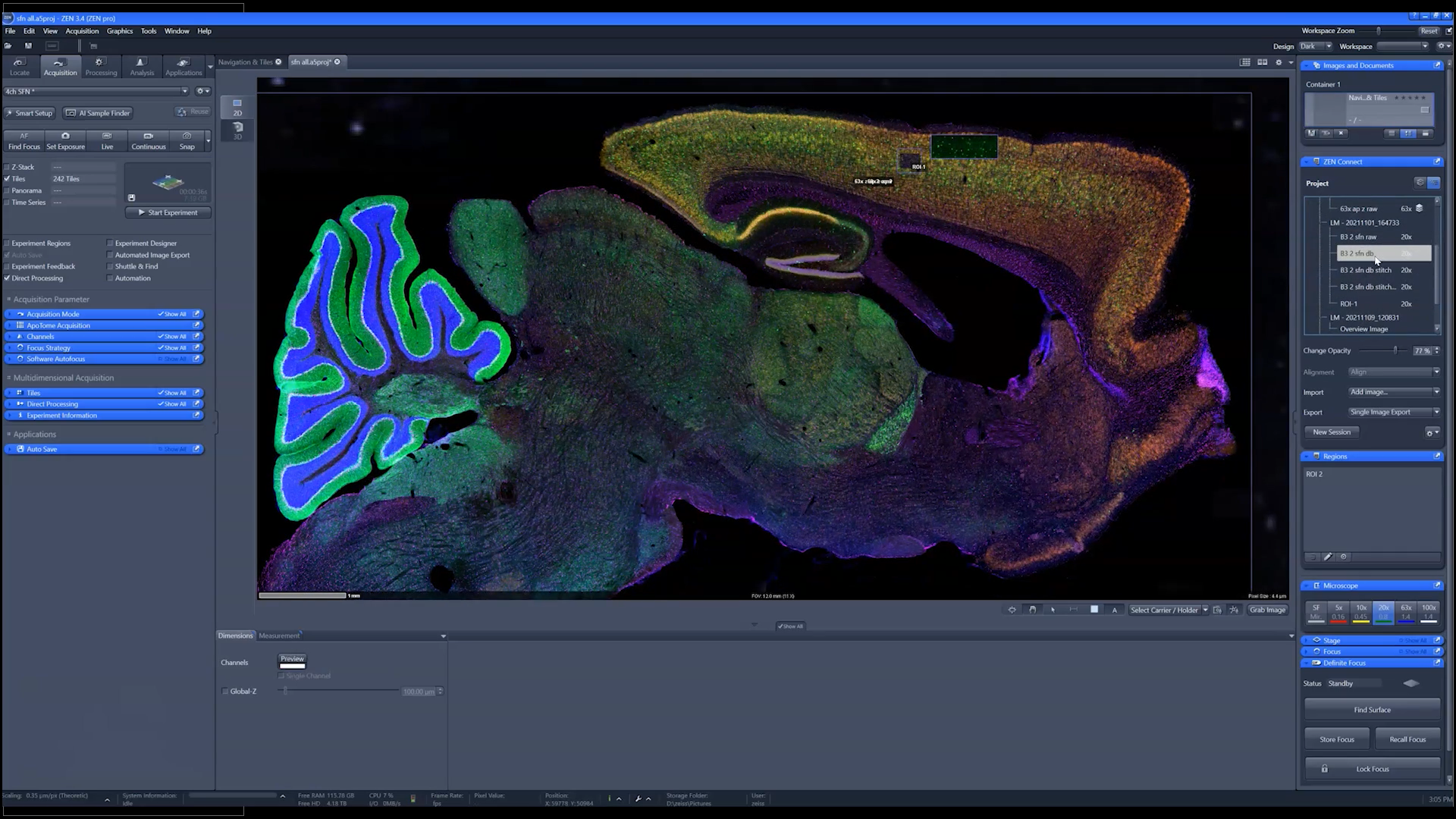 Deconvolution: Basics and Practice