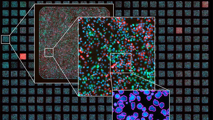 The Smart Microscope for Automated Workflows: Celldiscoverer 7 with LSM 900