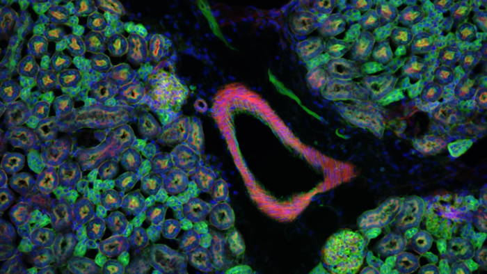 How to Perform Multichannel Fluorescence Imaging with Smart Microscopy and Automatic Exposure Mode 