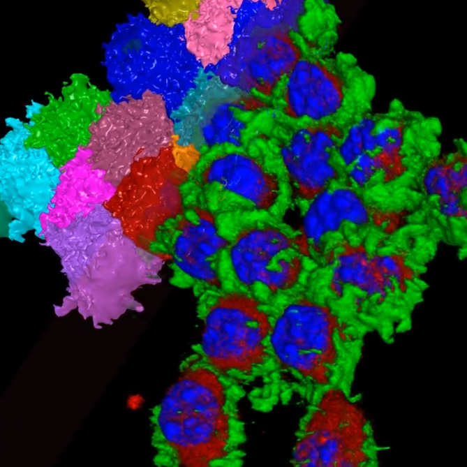 Region growing image analysis viewed in 3D