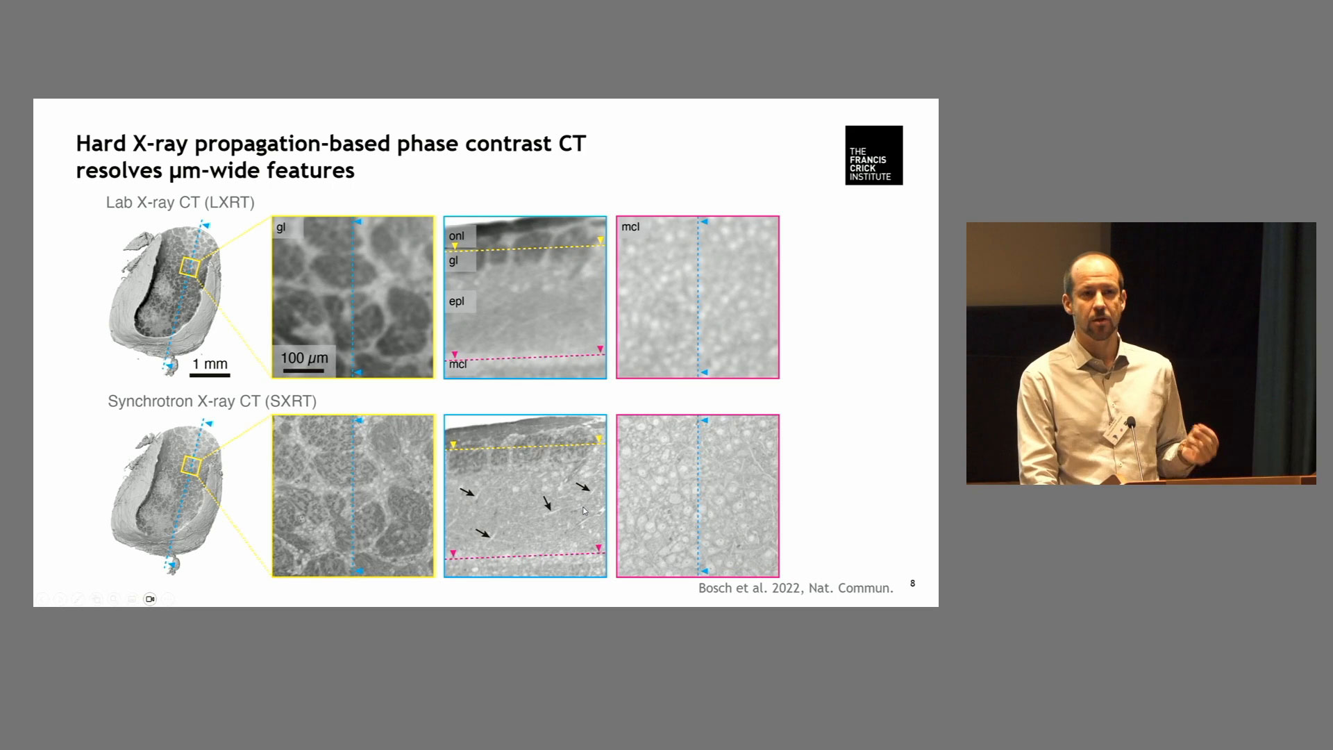 Combining 2-photon and X-Ray Microscopy in Neuroscience