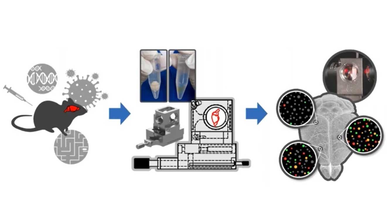 Brain-wide Quantification of Inflammation and Neural Activity at Single-cell Resolution