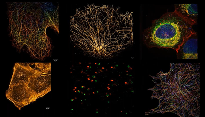 Revealing the Fastest Processes in Superresolution | ZEISS