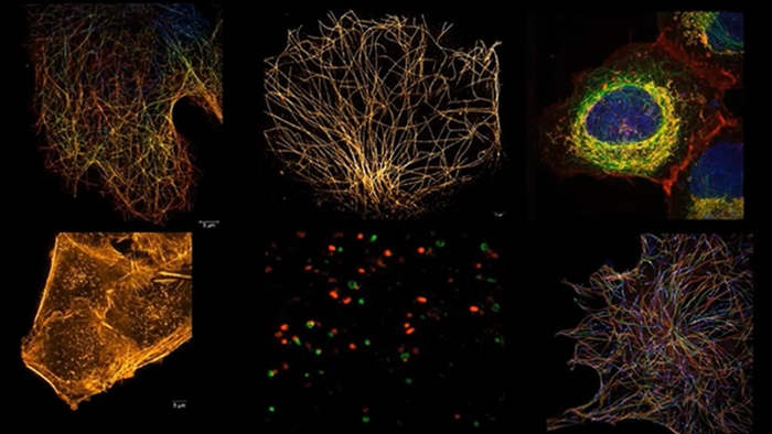 Revealing the Fastest Processes in Superresolution With Lattice SIM and ZEISS Elyra 7