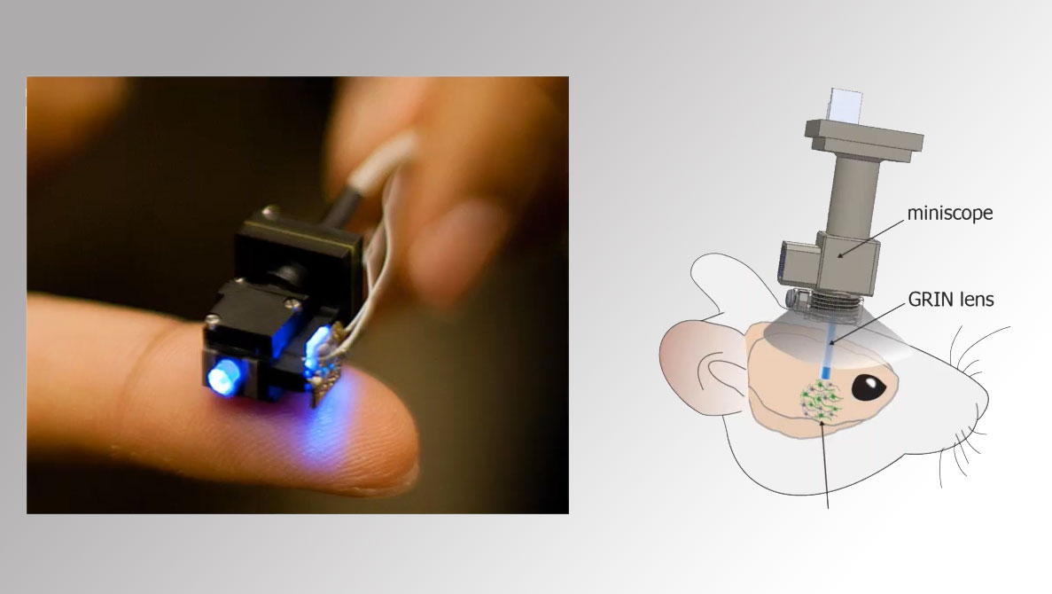 Highresolution confocal imaging inside living mouse brains