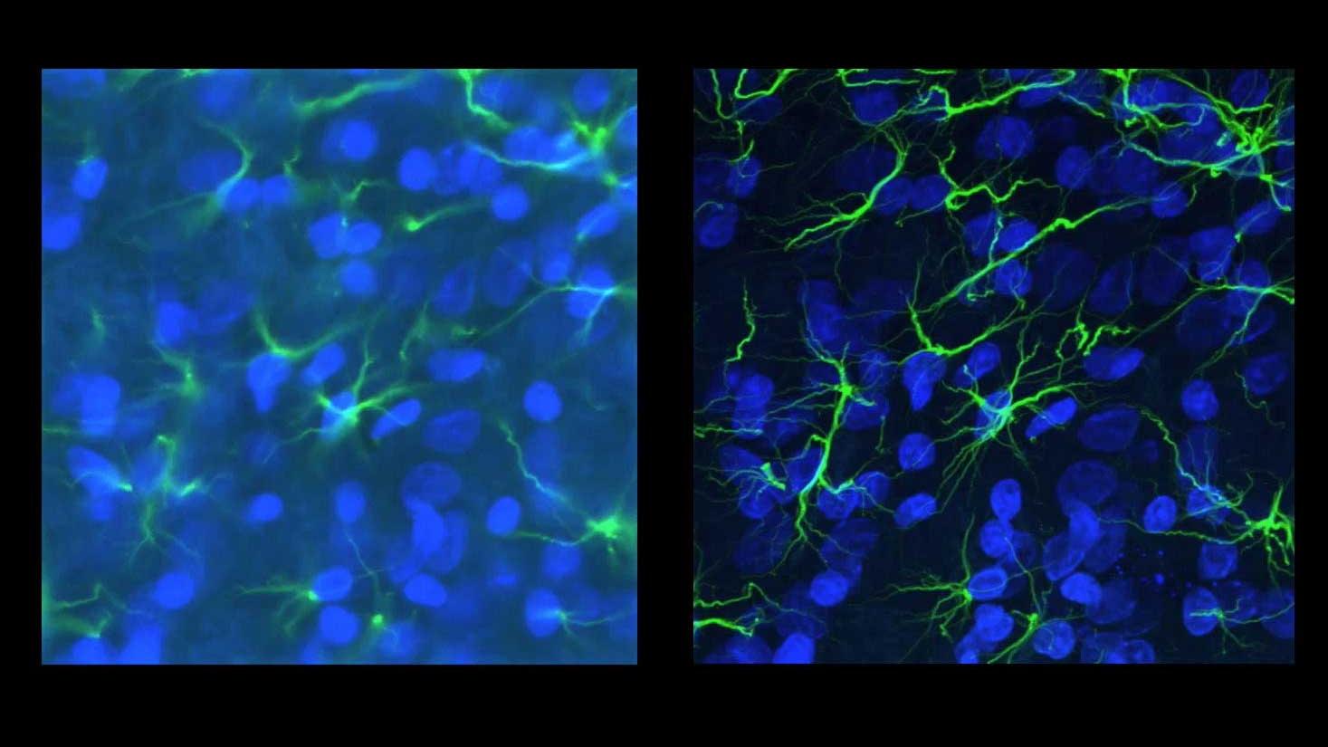 Basics of Confocal Microscopy