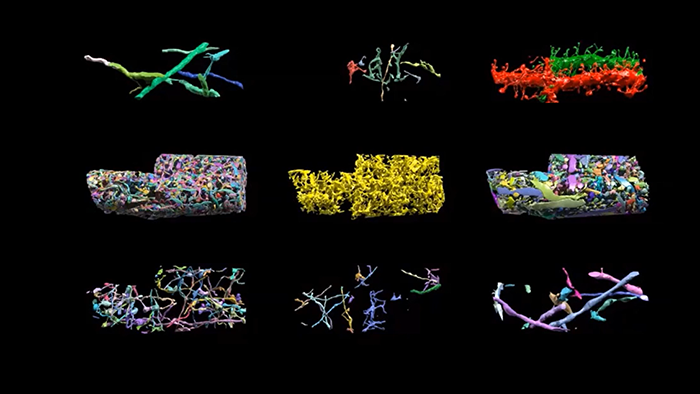 Why Scanning Electron Microscopy (SEM) is Important to Light Microscopy-based Research