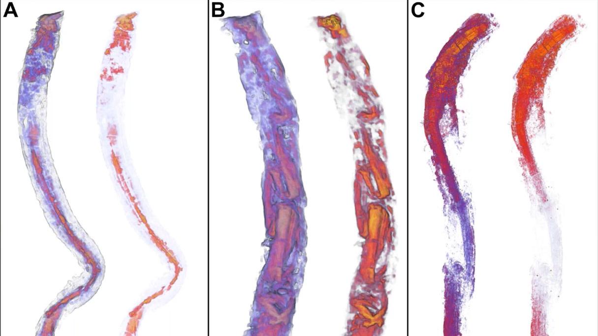 Efficient Microstructure Characterization of Metals using Light Microscopy