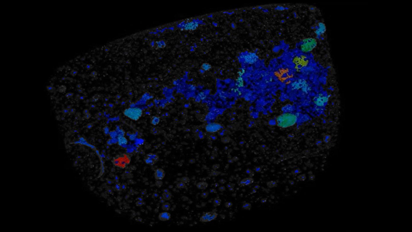 Concrete Imaging with X-ray Microscopy