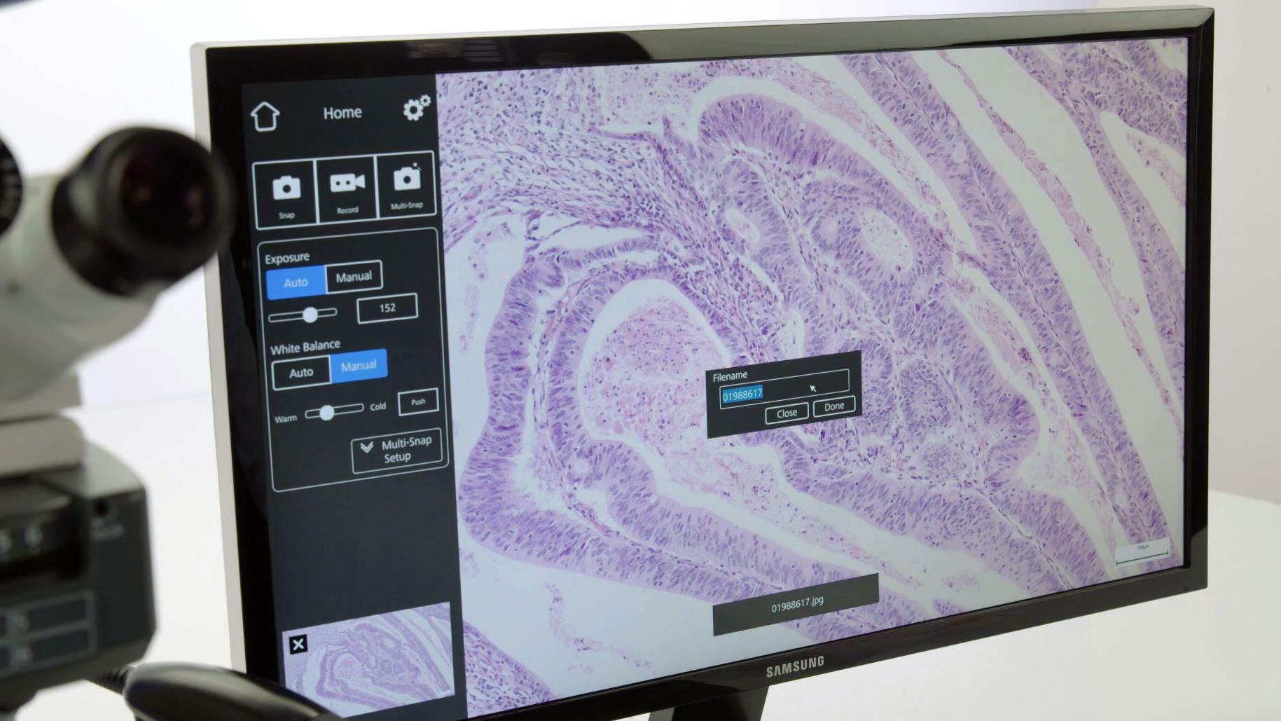 How to Perform Multichannel Fluorescence Imaging with Smart Microscopy and Automatic Exposure Mode 