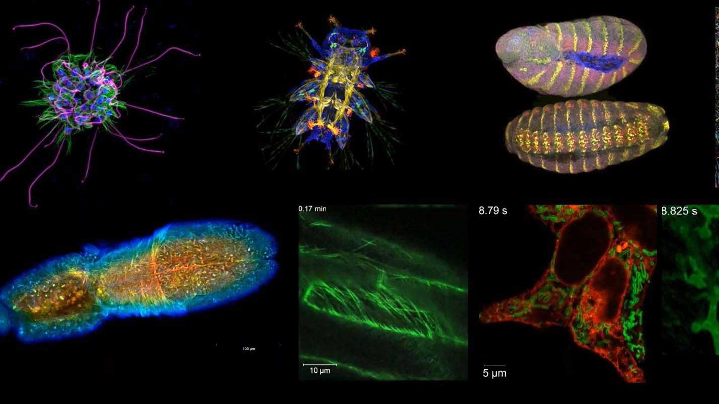 Imaging of Living Samples - New Technologies for Fast and Gentle Image Acquisition