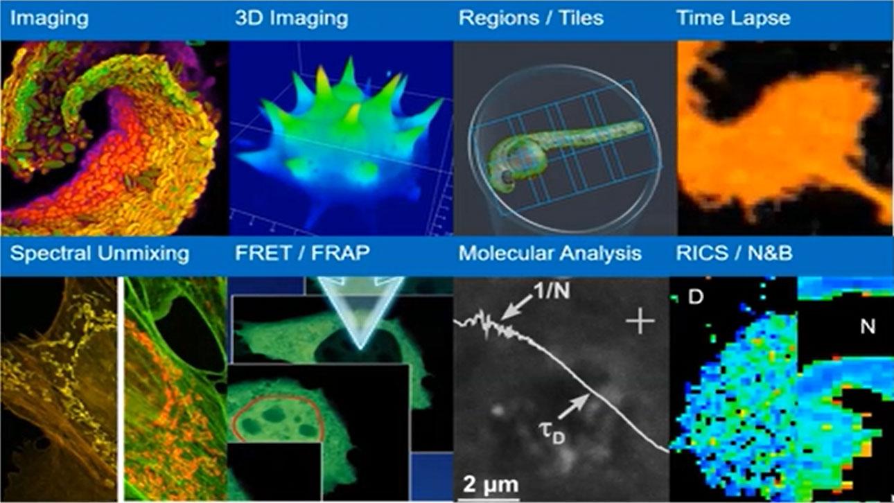 Brain-wide Quantification of Inflammation and Neural Activity at Single-cell Resolution