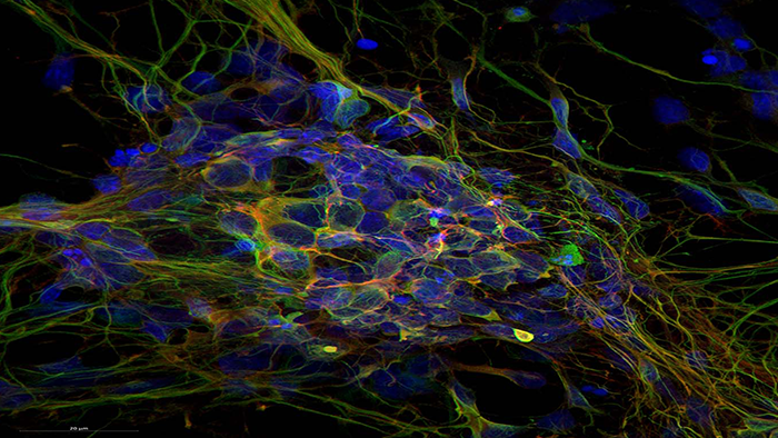The Countless Possibilities of Confocal Microscopy