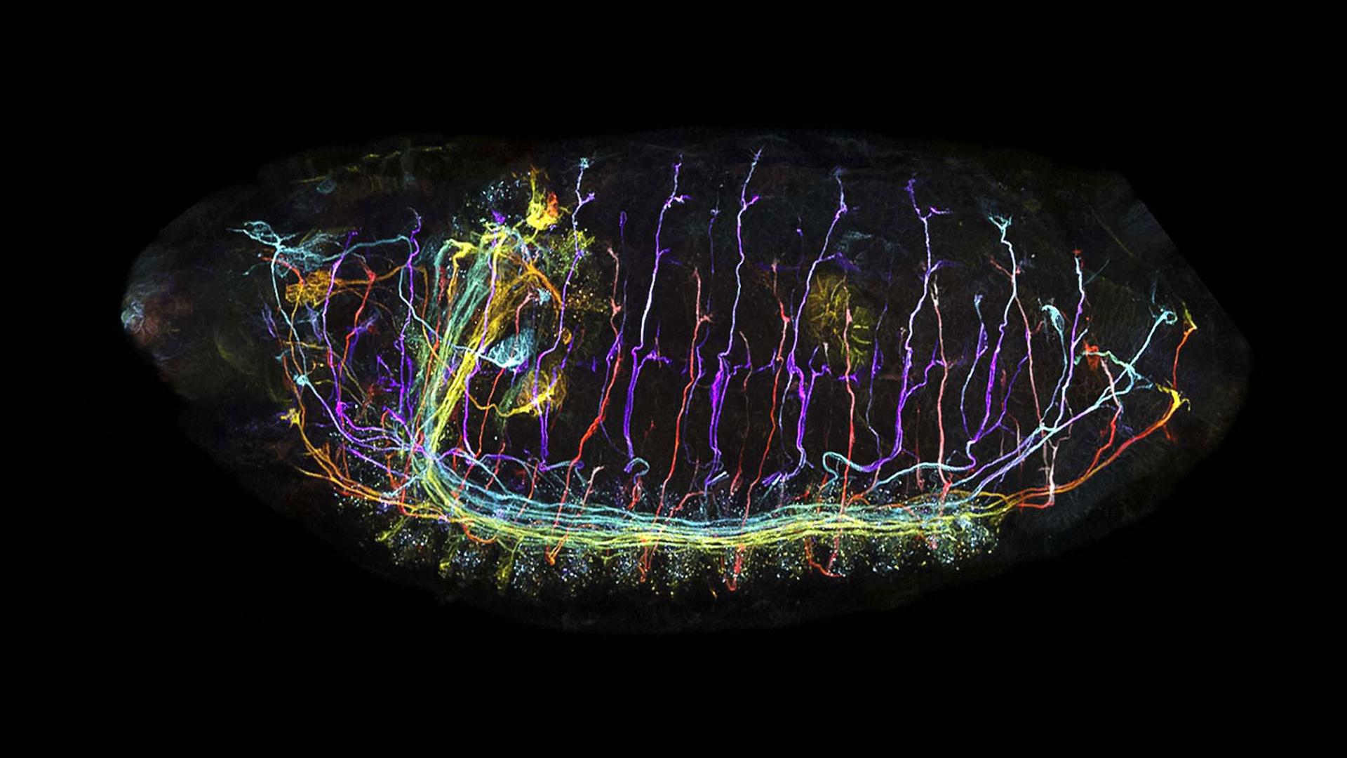 Sample Preparation for Fluorescence Microscope – Basic Introduction for Better Imaging Results