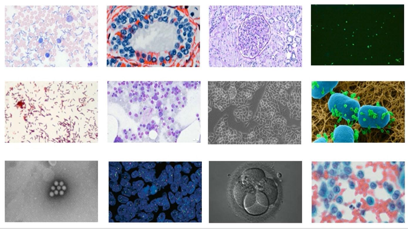 How to Perform Multichannel Fluorescence Imaging with Smart Microscopy and Automatic Exposure Mode 