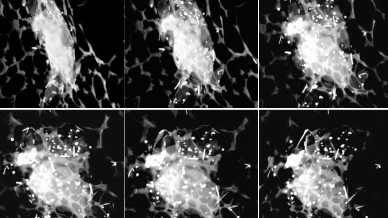 Transmission Imaging and Tomography in the SEM Platform