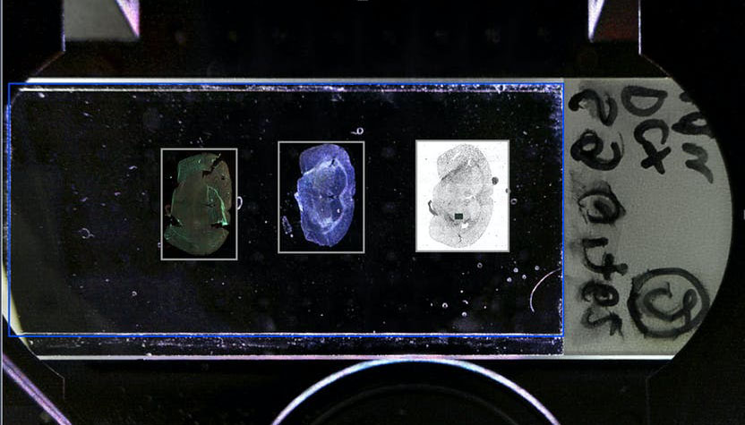 New perspectives in optical microscopy | ZEISS
