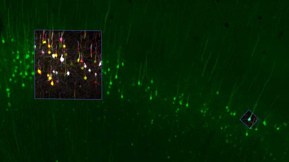 Connected and Correlative Microscopy - Overlay and Organize Images from any Source to Connect Your Multimodal Data