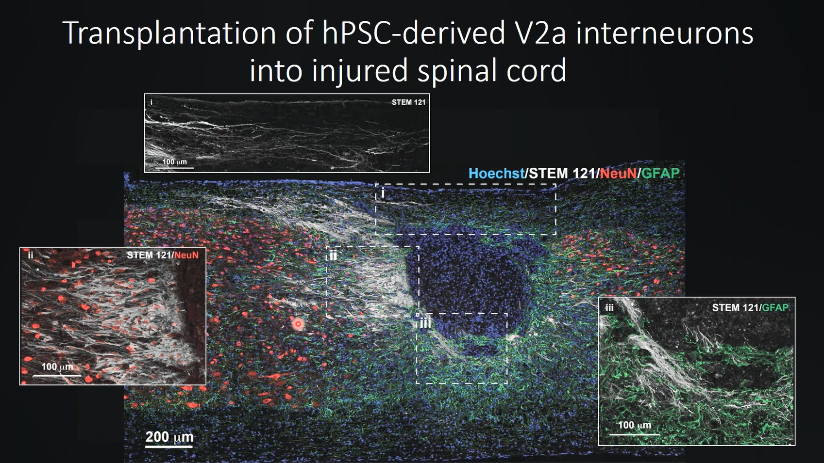 Discover a New Light Sheet Microscope for Multiview Imaging of Living and Cleared Specimens