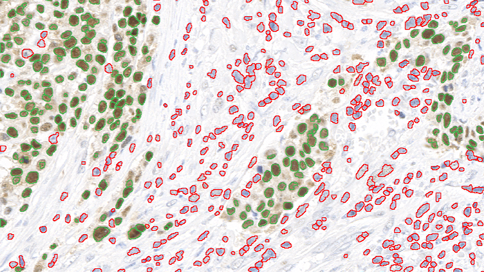 Image Analysis: Basics and Practice - How Can We Use Image Analysis in Microscopy Related Research