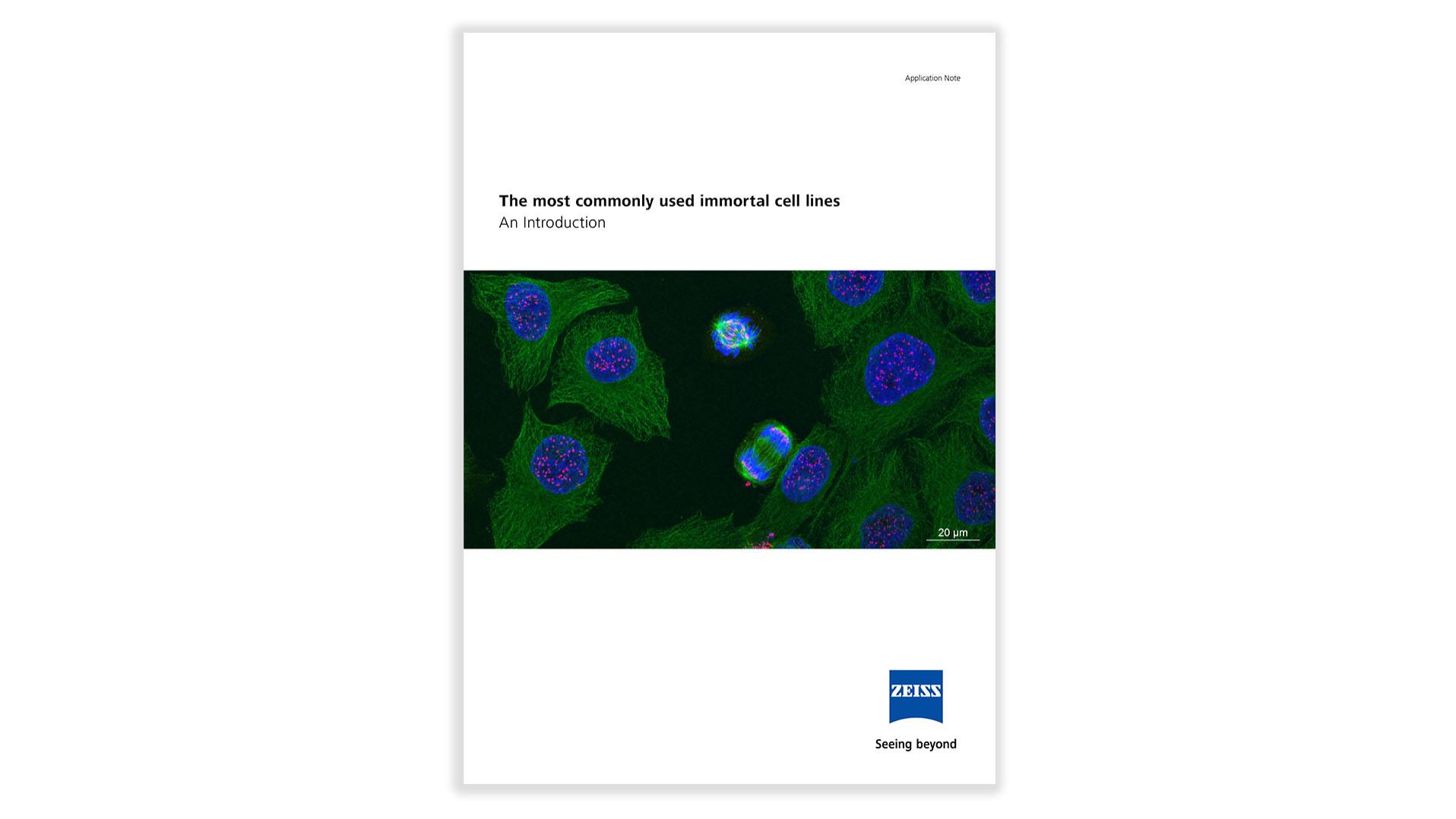 How to Get Better Fluorescence Images with Your Widefield Microscope