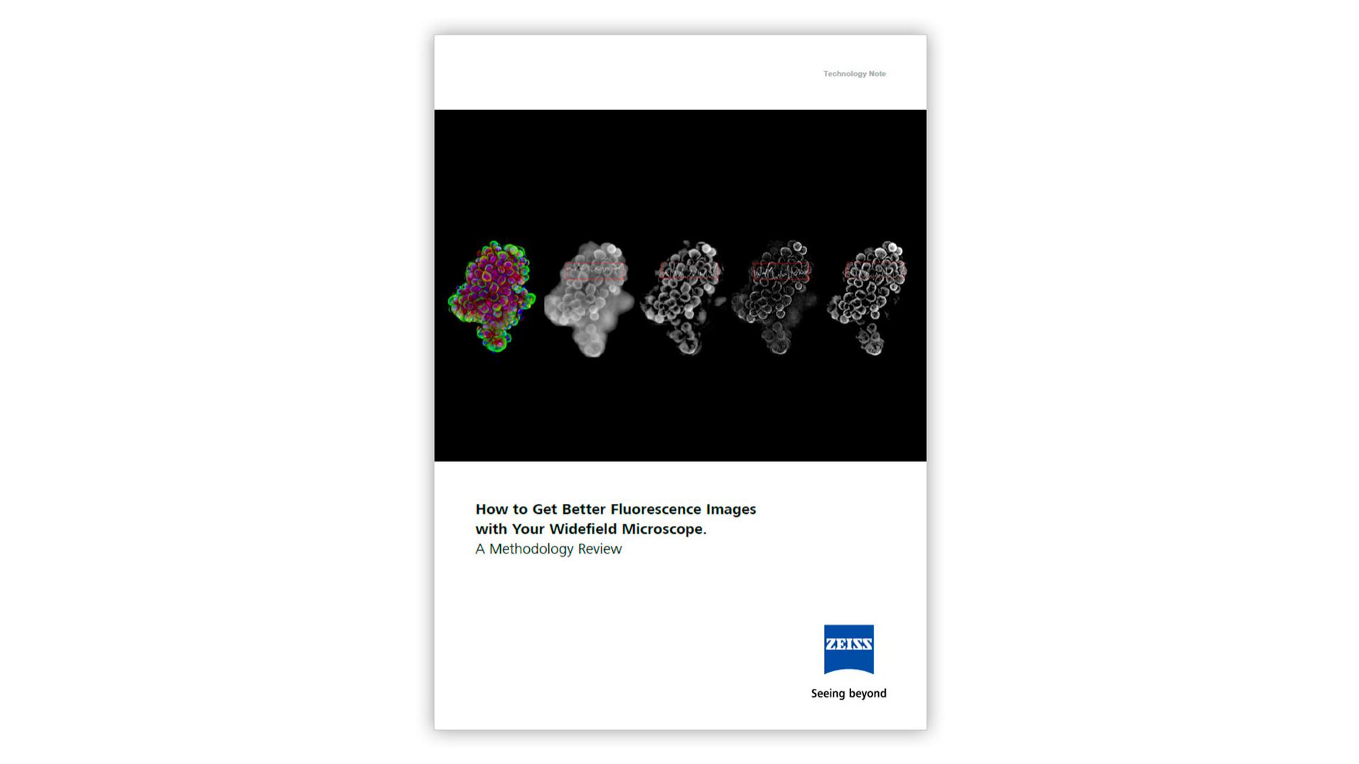 How to Get Better Fluorescence Images with Your Widefield Microscope