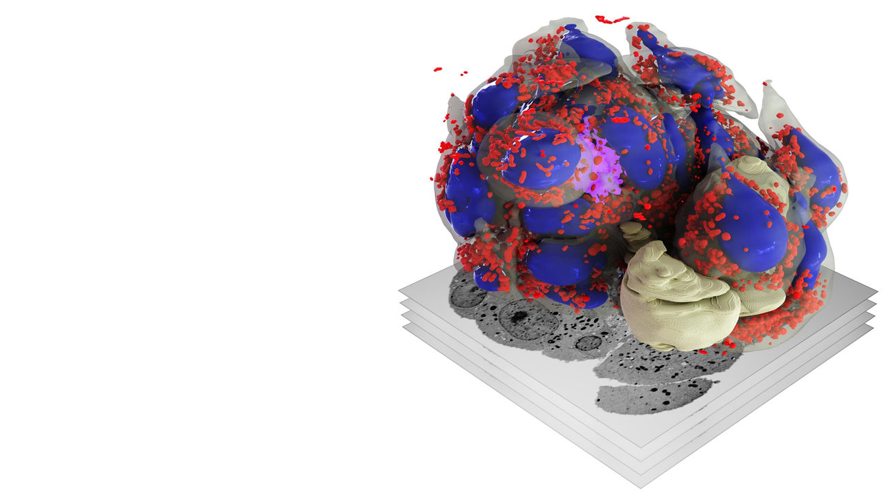 3D reconstruction of a tumorsphere created using SBF-SEM with ZEISS Sigma FE-SEM
