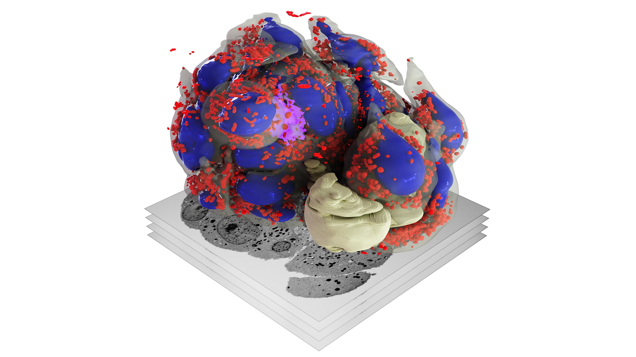 3D reconstruction of the  microtubule cytoskeleton in a whole Jurkat cell (immortalized human T lymphocyte) using single molecule localization data from lattice light-sheet microscopy