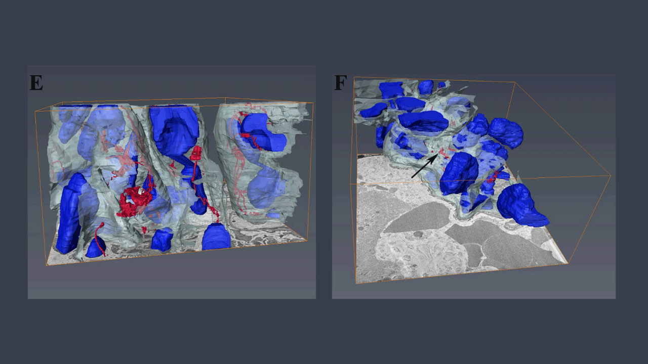 3D ultrastructure of the Fibers of the Elastic Fiber System (FEFS) shown in red, capillary in white, and cells in blue. Lateral plane. Wild type (left) presents FEFS arranged in a tubular-shaped network (white arrow) within the capillary. MFS (right) presents fractured FEFS (black arrow), and loss of capillary structure.