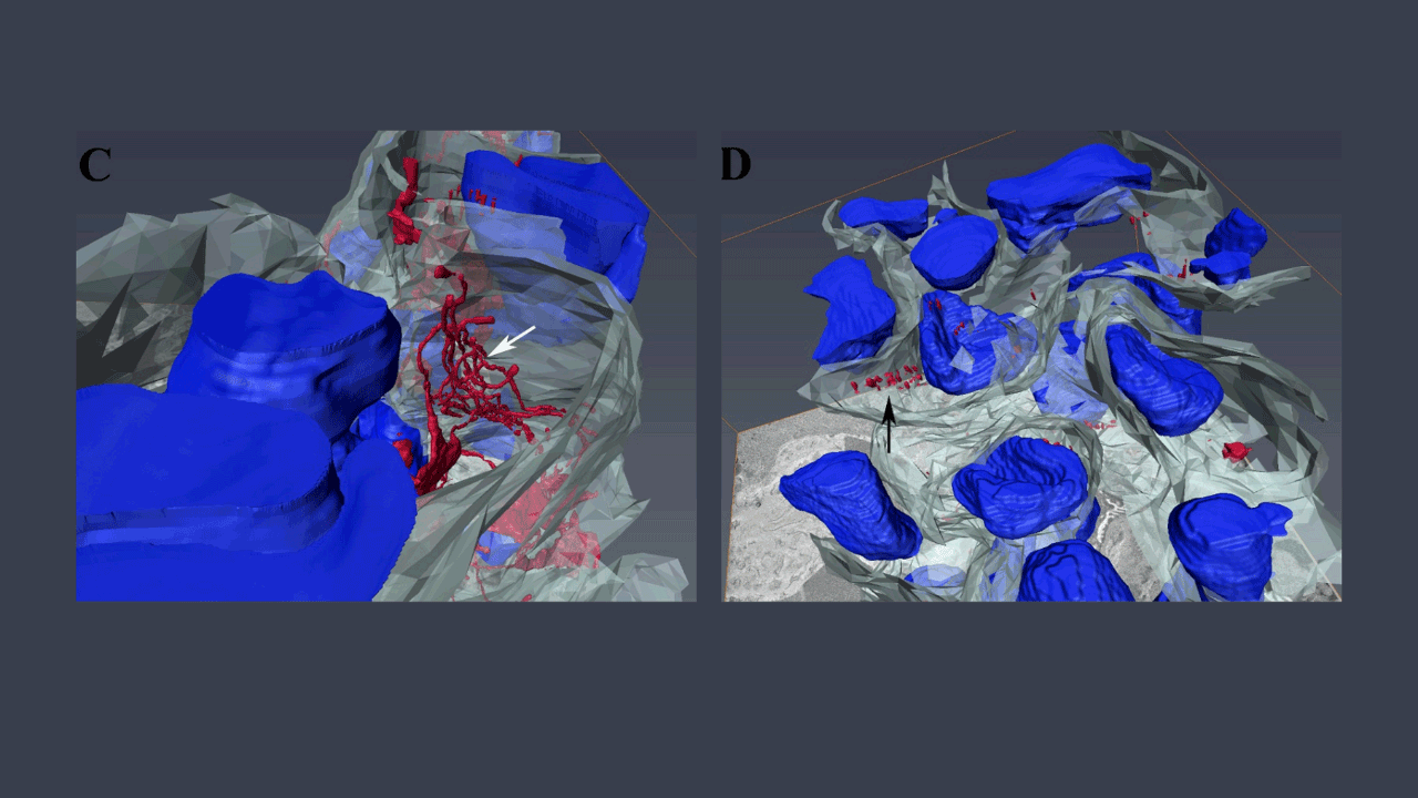 3D ultrastructure of the Fibers of the Elastic Fiber System (FEFS) shown in red, capillary in white, and cells in blue. Superior plane in higher magnification. Wild type (left) presents FEFS arranged in a tubular-shaped network (white arrow) within the capillary. MFS (right) presents fractured FEFS (black arrow), and loss of capillary structure.